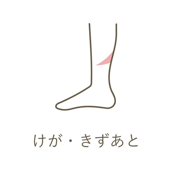 けが・きずあと